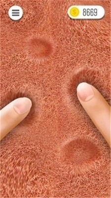 ճҺս